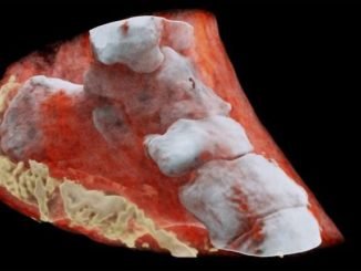 2ea95 renkli ve 3 boyutlu rc3b6ntgen c4b0nsan c39czerinde c4b0lk kez denendi