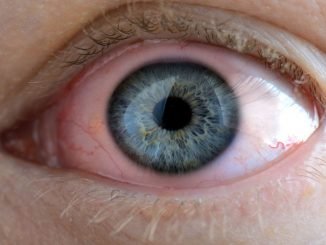 gozde siddetli capaklanmaya dikkat