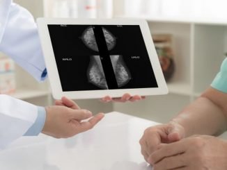 mamografinizin sonucunun supheli olmasi ne anlama gelir