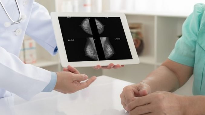 mamografinizin sonucunun supheli olmasi ne anlama gelir mamografinizin sonucunun supheli olmasi ne anlama gelir