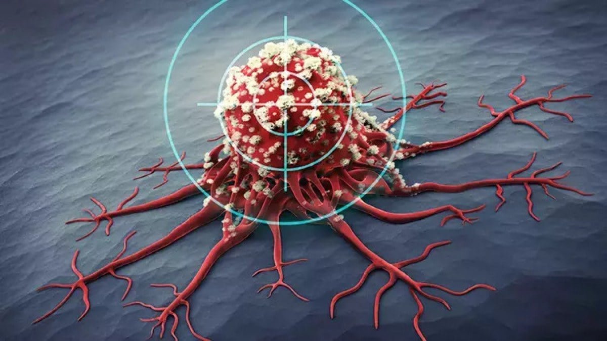 Kanserin Geç Teşhis Edilmesinin Olası Sonuçları