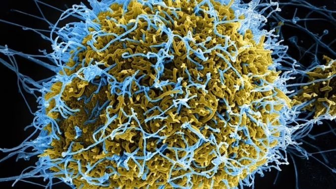 cinli-bilim-insanlarindan-ebola-deneyi-fAhNCvGB.jpg
