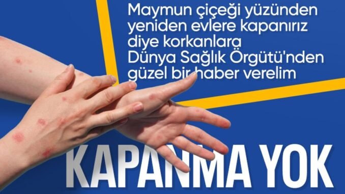 dunya-saglik-orgutunden-m-cicegi-virusu-aciklamalari-T1PpqvXm.jpg