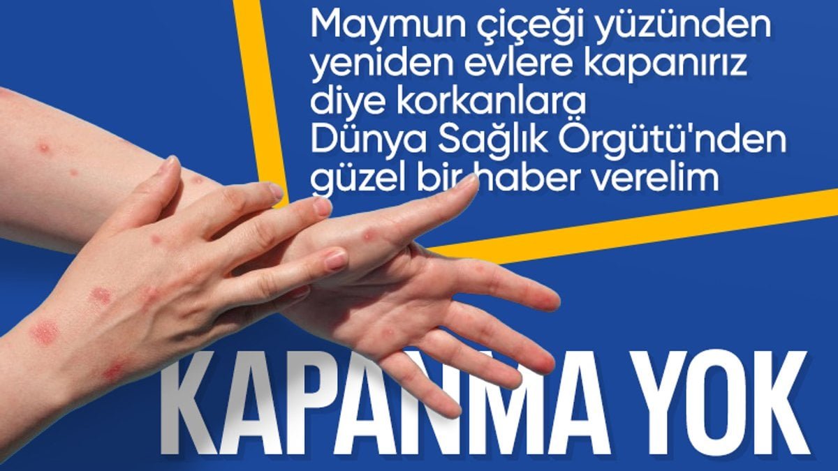 dunya-saglik-orgutunden-m-cicegi-virusu-aciklamalari-T1PpqvXm.jpg