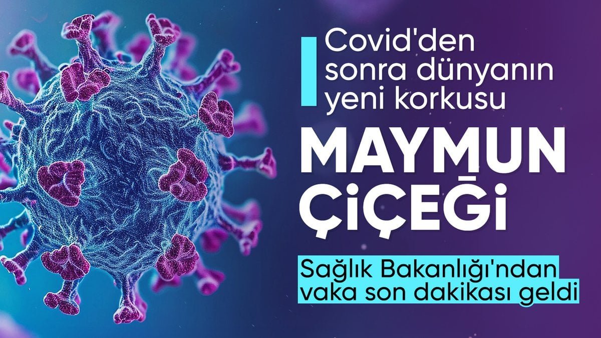 son-dakika-sihhat-bakanligindan-maymun-cicegi-aciklamasi-hadiseye-rastlanmadi-mpdgmxTV.jpg