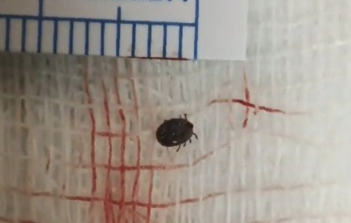 bitliste-12-yasindaki-cocugun-gozunden-canli-kene-cikarildi-0-FhsPsDUp.jpg