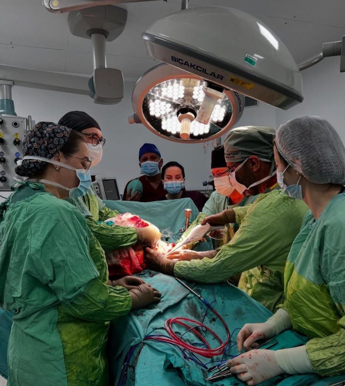 Trabzon'da 26 Kilogramlık Tümör Ameliyatı Başarıyla Gerçekleştirildi